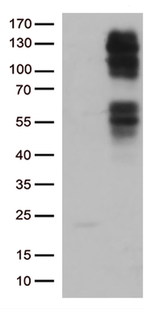 FGFR2 Antibody in Western Blot (WB)