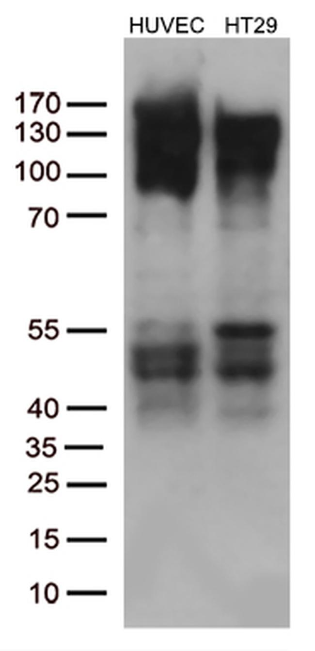 FGFR2 Antibody in Western Blot (WB)