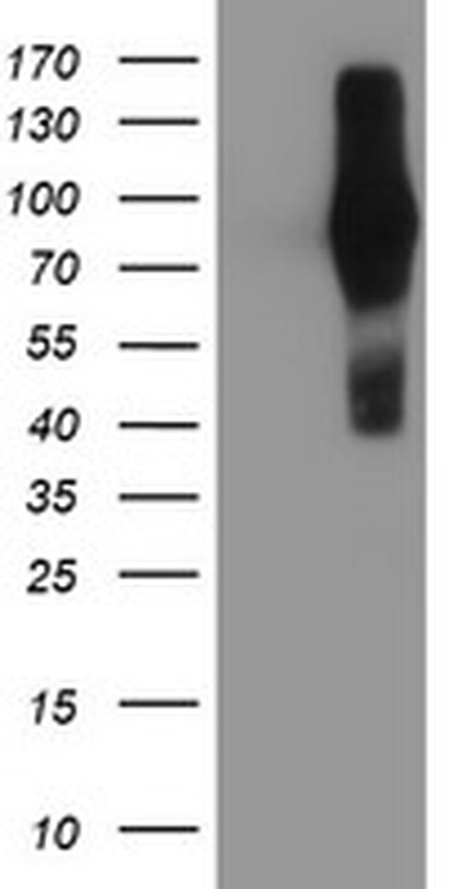 FGFR2 Antibody in Western Blot (WB)