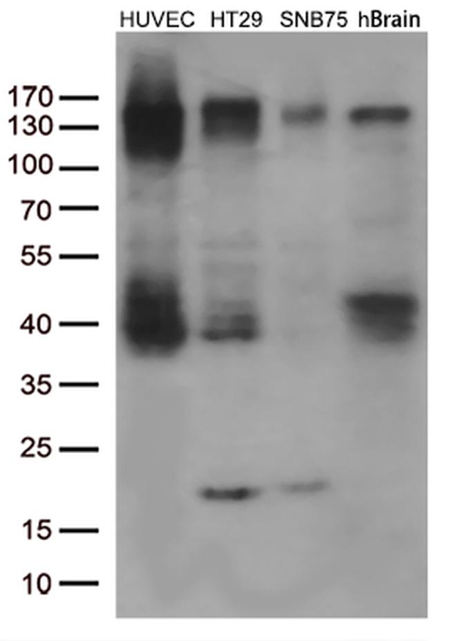 FGFR2 Antibody in Western Blot (WB)