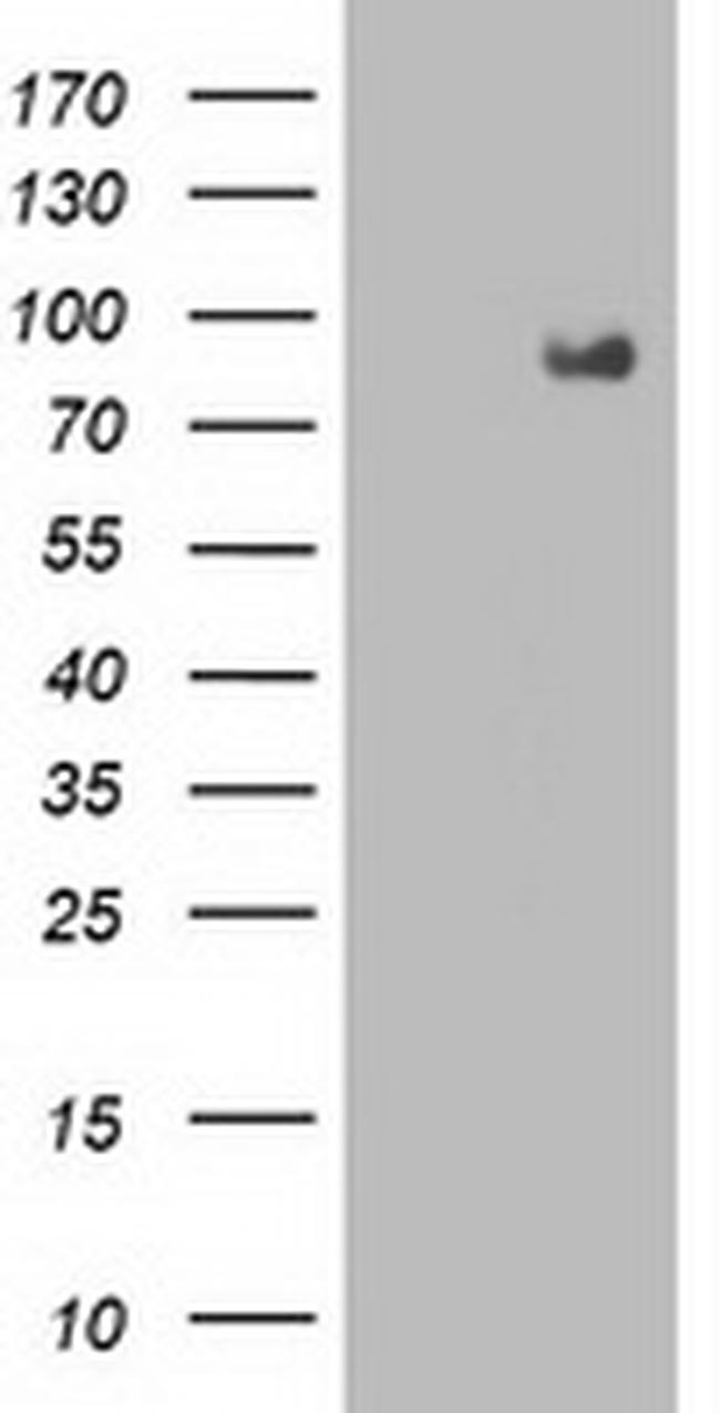 FGFR2 Antibody in Western Blot (WB)