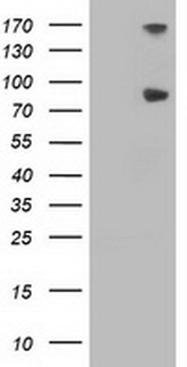 FGFR2 Antibody in Western Blot (WB)