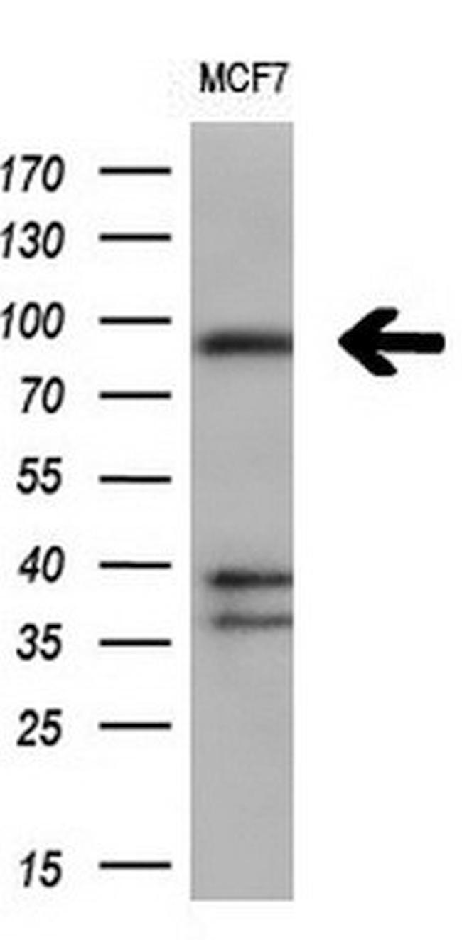 FGFR2 Antibody in Western Blot (WB)