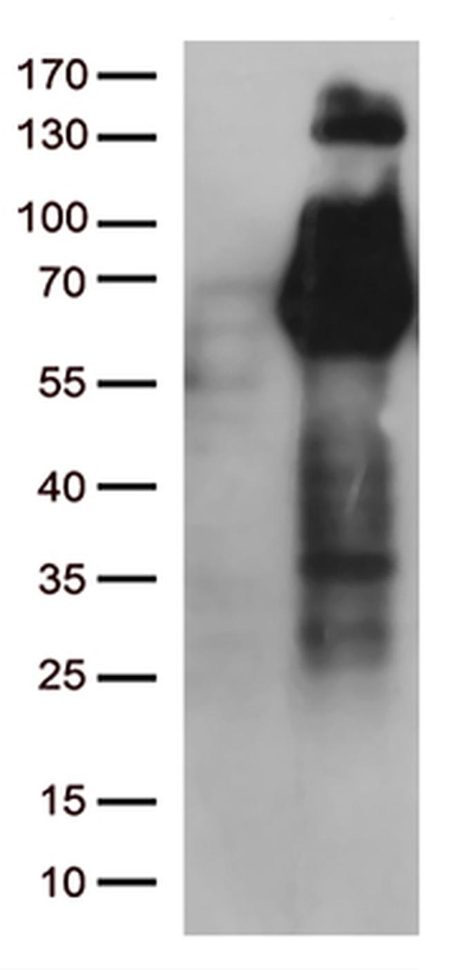 FGFR2 Antibody in Western Blot (WB)