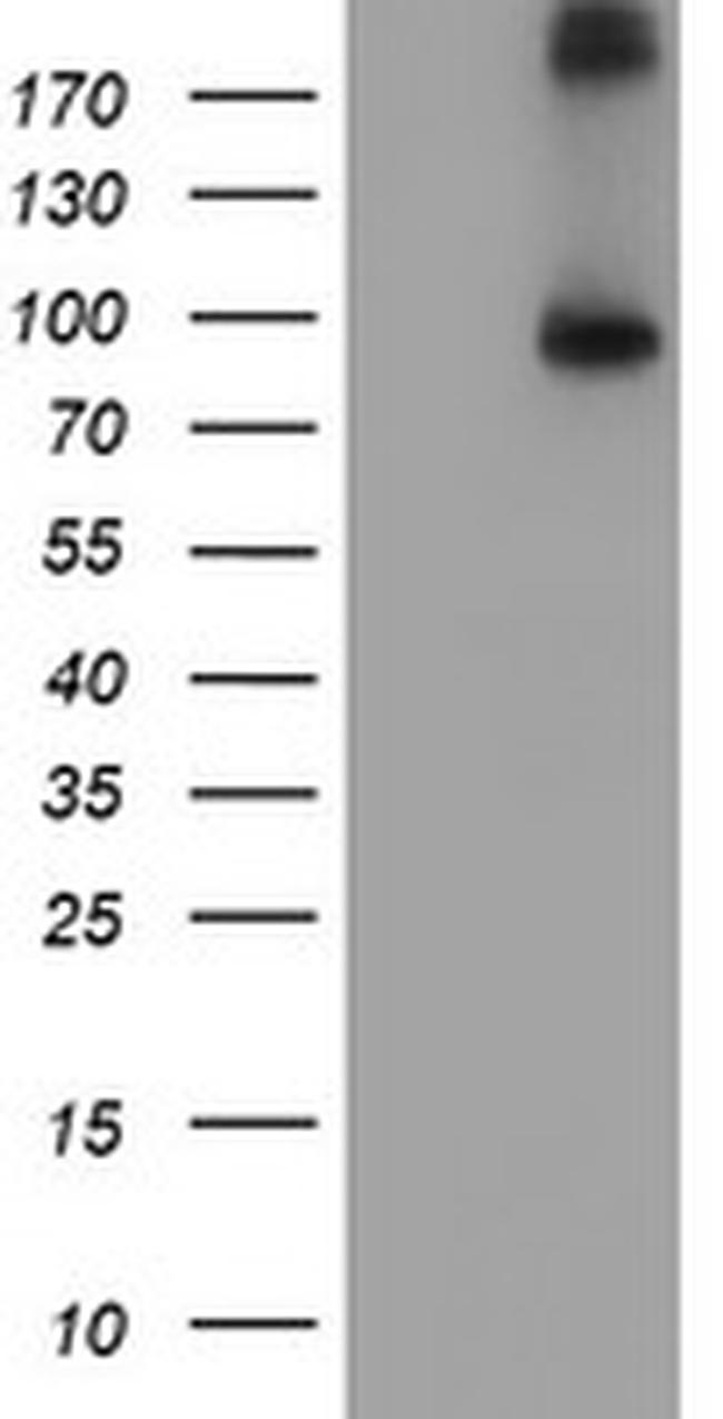 FGFR2 Antibody in Western Blot (WB)