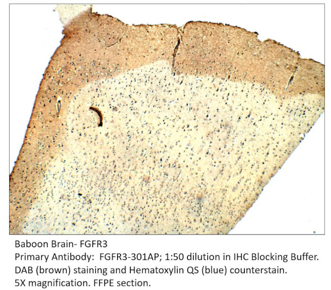 FGFR3 Antibody in Immunohistochemistry (IHC)