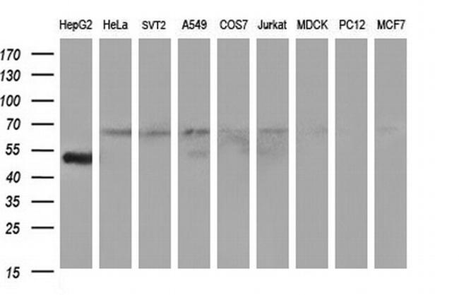 FGG Antibody in Western Blot (WB)