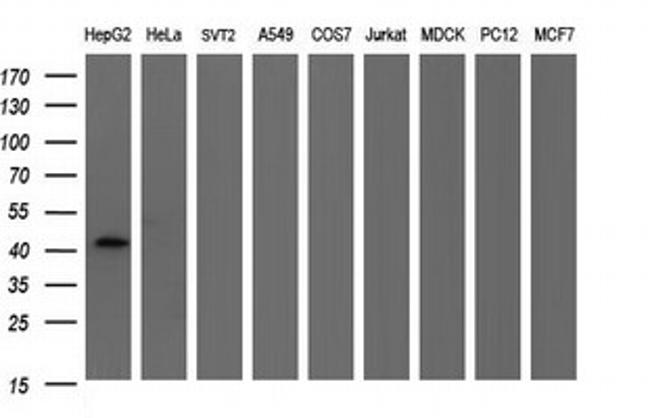 FGG Antibody in Western Blot (WB)