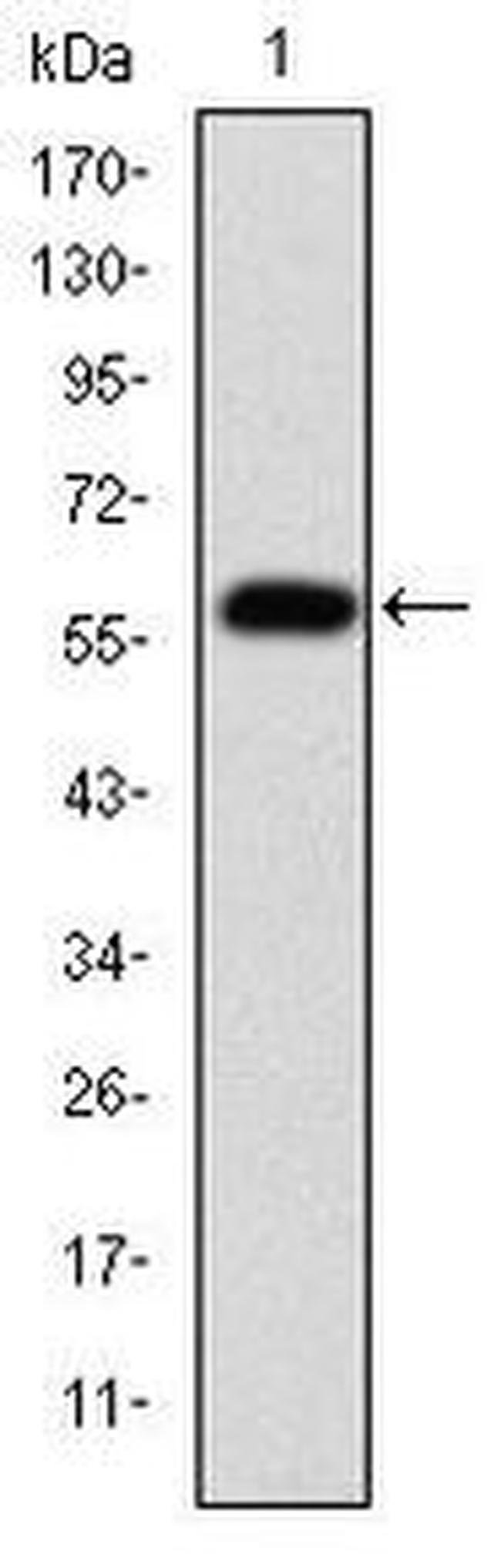 Fibrinogen gamma Antibody in Western Blot (WB)