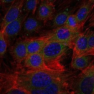 Fibrinogen gamma Antibody in Immunocytochemistry (ICC/IF)