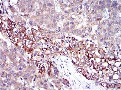 Fibrinogen gamma Antibody in Immunohistochemistry (Paraffin) (IHC (P))