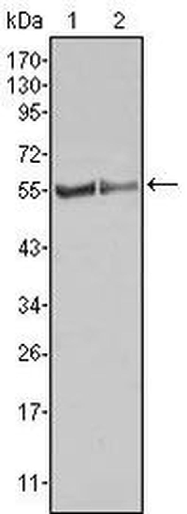 FGR Antibody in Western Blot (WB)