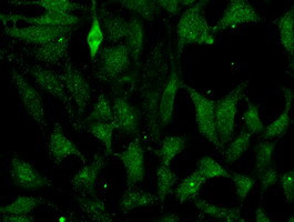 FH Antibody in Immunocytochemistry (ICC/IF)