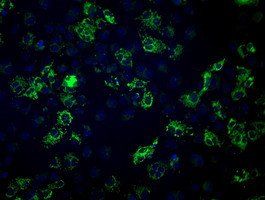 FH Antibody in Immunocytochemistry (ICC/IF)