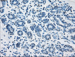 FH Antibody in Immunohistochemistry (Paraffin) (IHC (P))