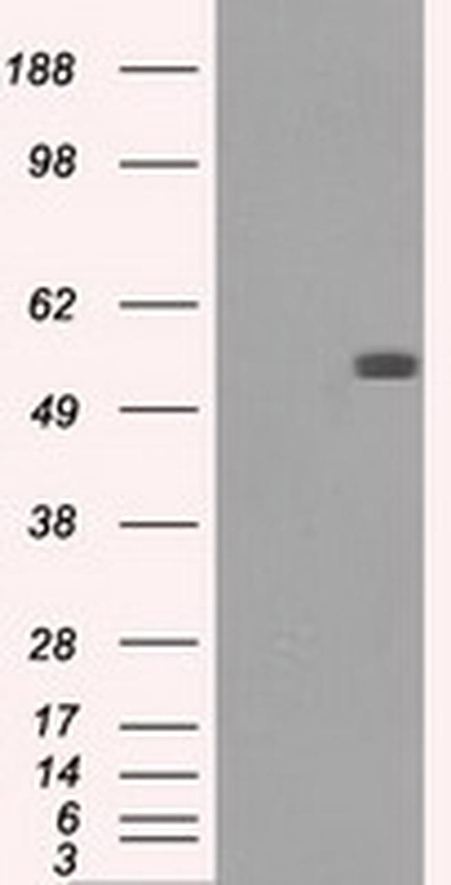 FH Antibody in Western Blot (WB)