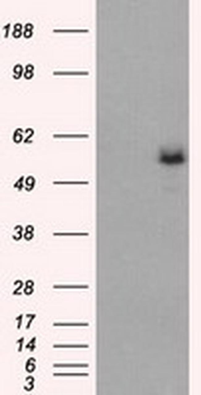 FH Antibody in Western Blot (WB)