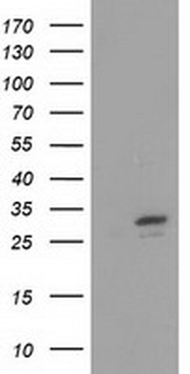 FHL1 Antibody in Western Blot (WB)