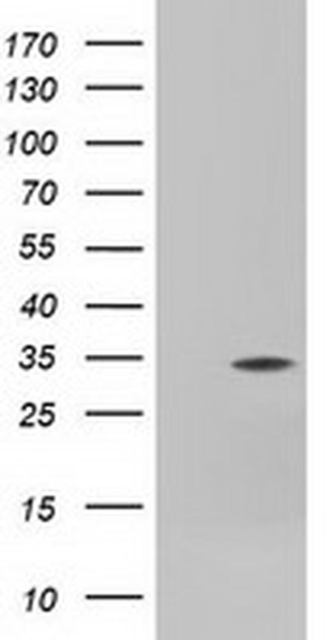 FHL1 Antibody in Western Blot (WB)