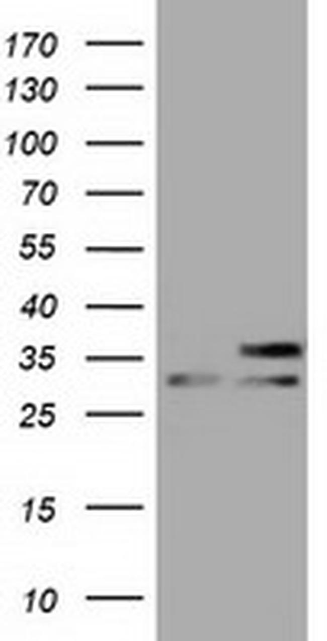 FHL1 Antibody in Western Blot (WB)