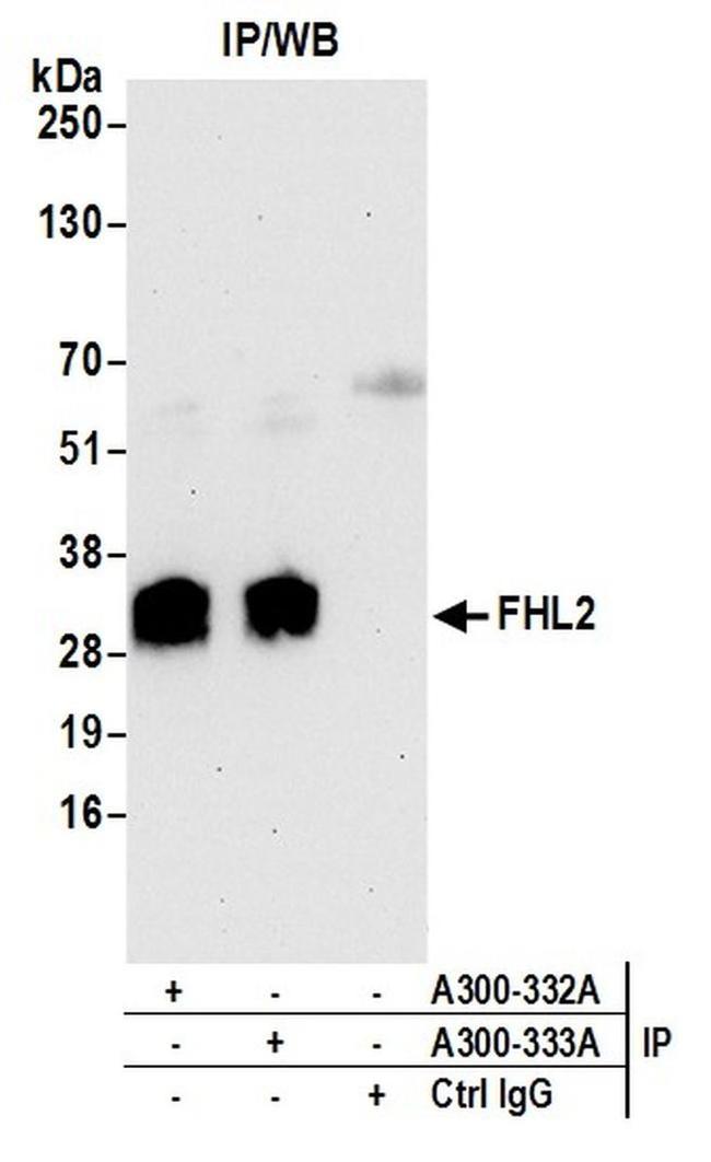 FHL2 Antibody in Western Blot (WB)