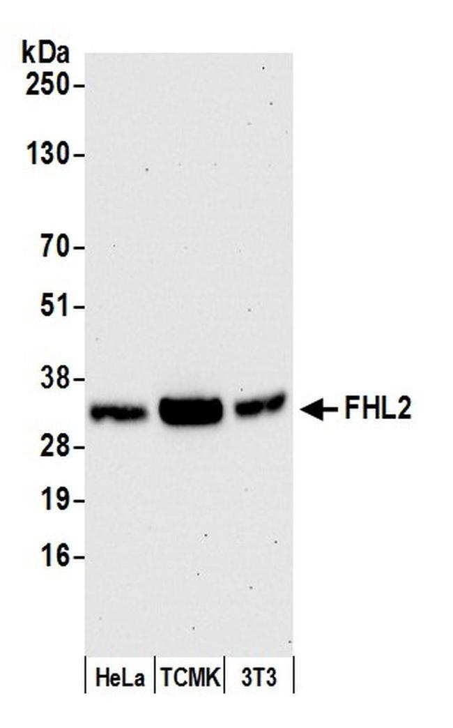 FHL2 Antibody in Western Blot (WB)