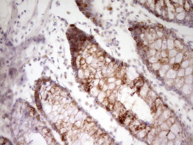 FIGF Antibody in Immunohistochemistry (Paraffin) (IHC (P))