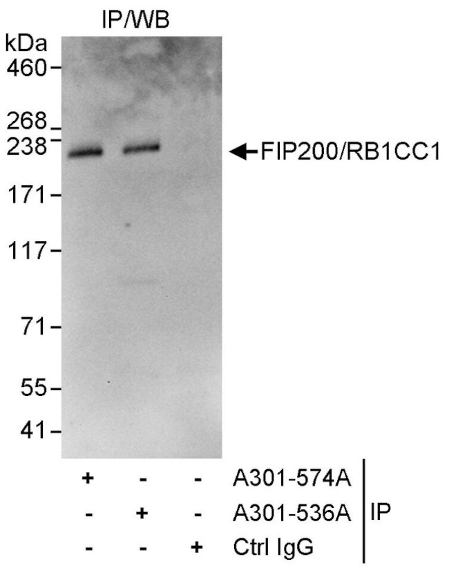 FIP200/RB1CC1 Antibody in Immunoprecipitation (IP)