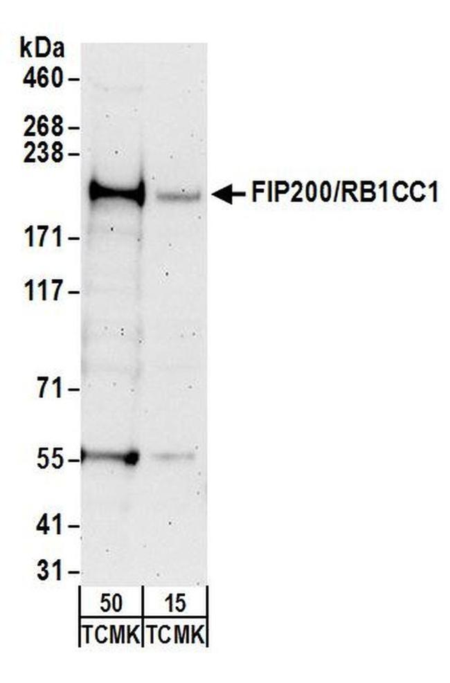 FIP200/RB1CC1 Antibody in Western Blot (WB)