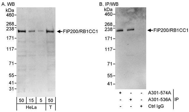 FIP200/RB1CC1 Antibody in Western Blot (WB)