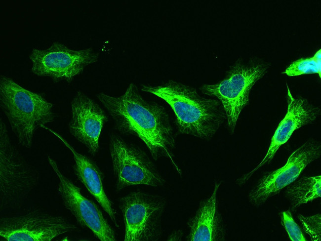 Cytokeratin 18 Antibody in Immunocytochemistry (ICC/IF)