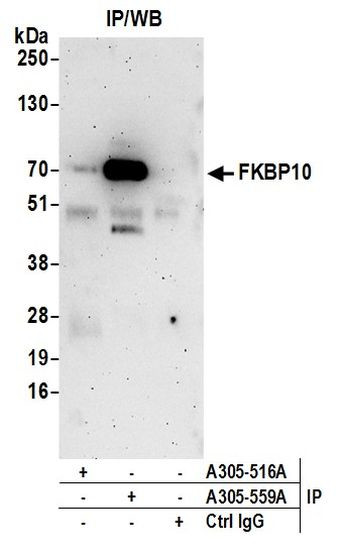 FKBP10 Antibody in Immunoprecipitation (IP)