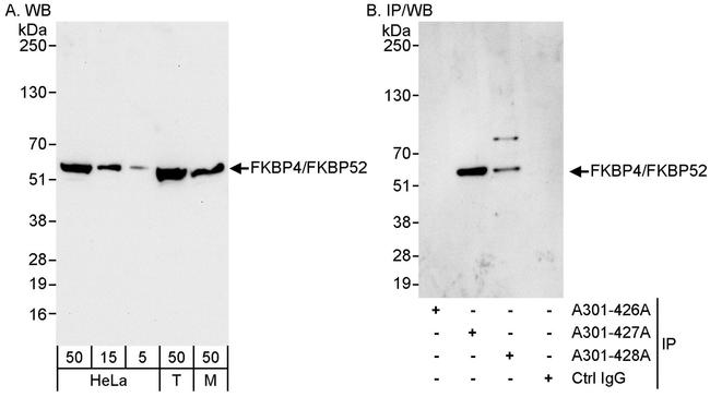 FKBP4/FKBP52 Antibody in Western Blot (WB)