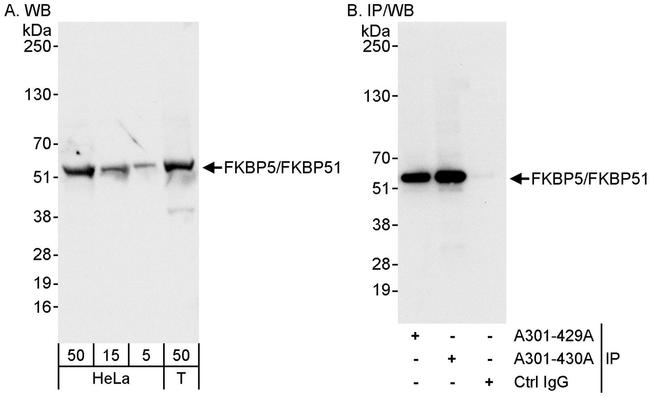 FKBP5/FKBP51 Antibody in Western Blot (WB)