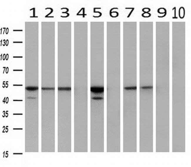 FKBP5 Antibody in Western Blot (WB)