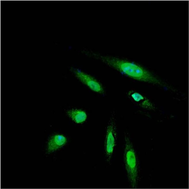 DYKDDDDK Tag Antibody in Immunocytochemistry (ICC/IF)