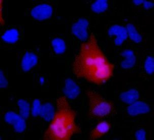 DYKDDDDK Tag Antibody in Immunocytochemistry (ICC/IF)