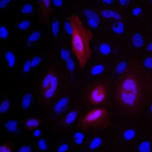 DYKDDDDK Tag Antibody in Immunocytochemistry (ICC/IF)