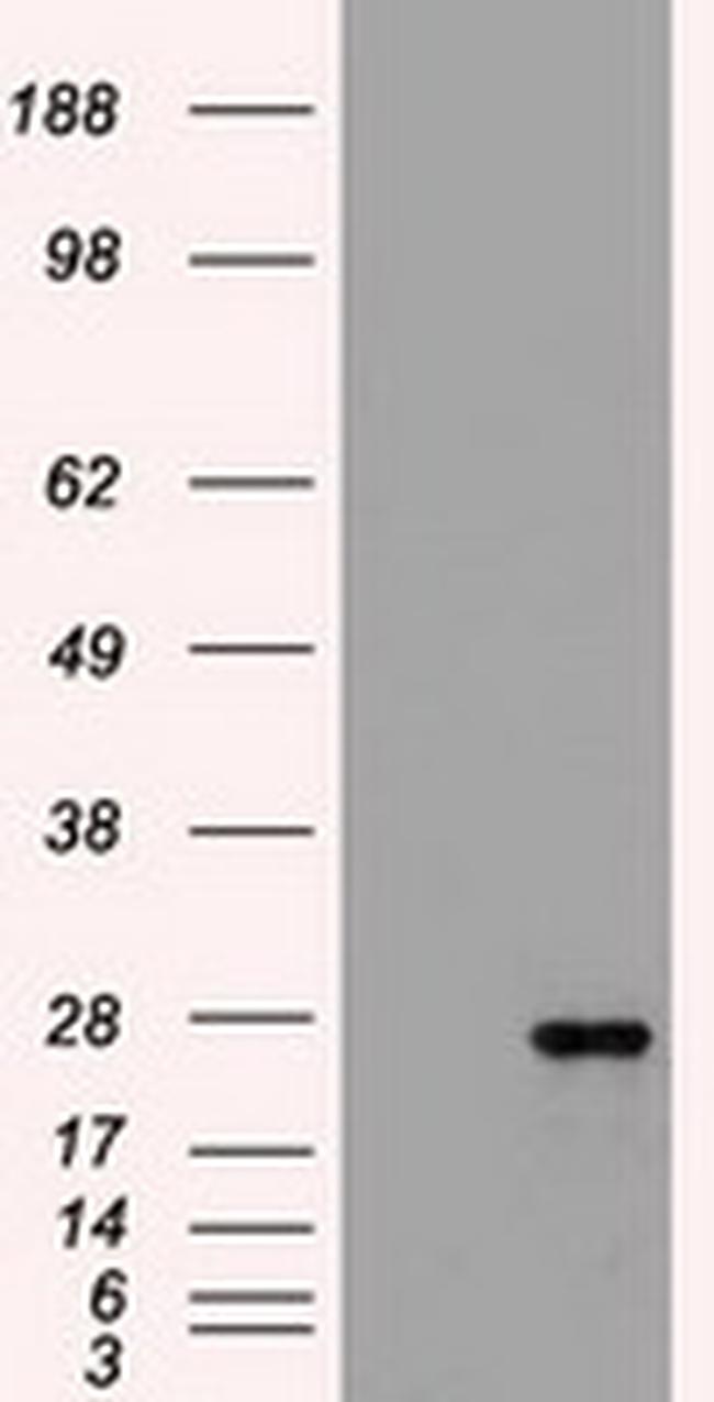 FLT3LG Antibody in Western Blot (WB)