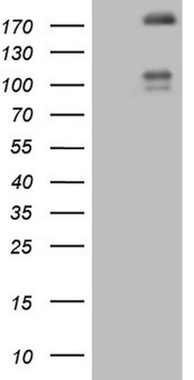 FLT4 Antibody in Western Blot (WB)