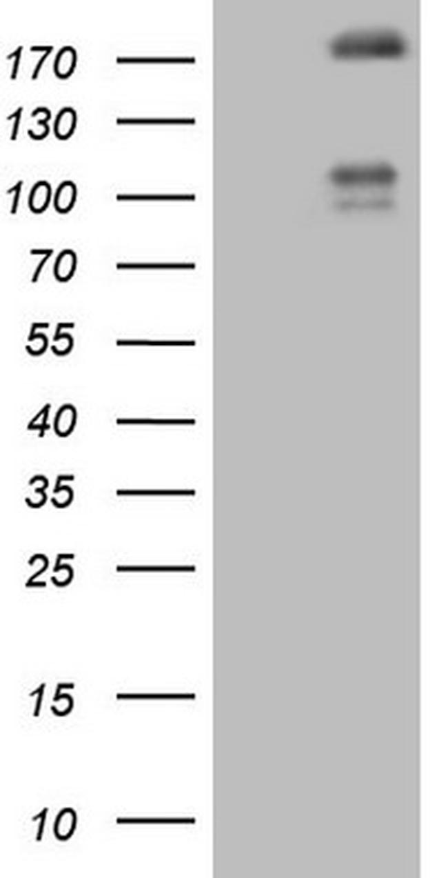 FLT4 Antibody in Western Blot (WB)