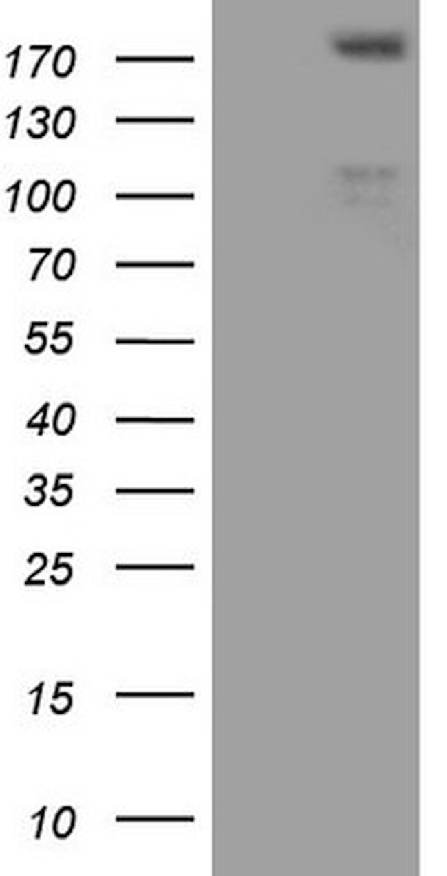 FLT4 Antibody in Western Blot (WB)