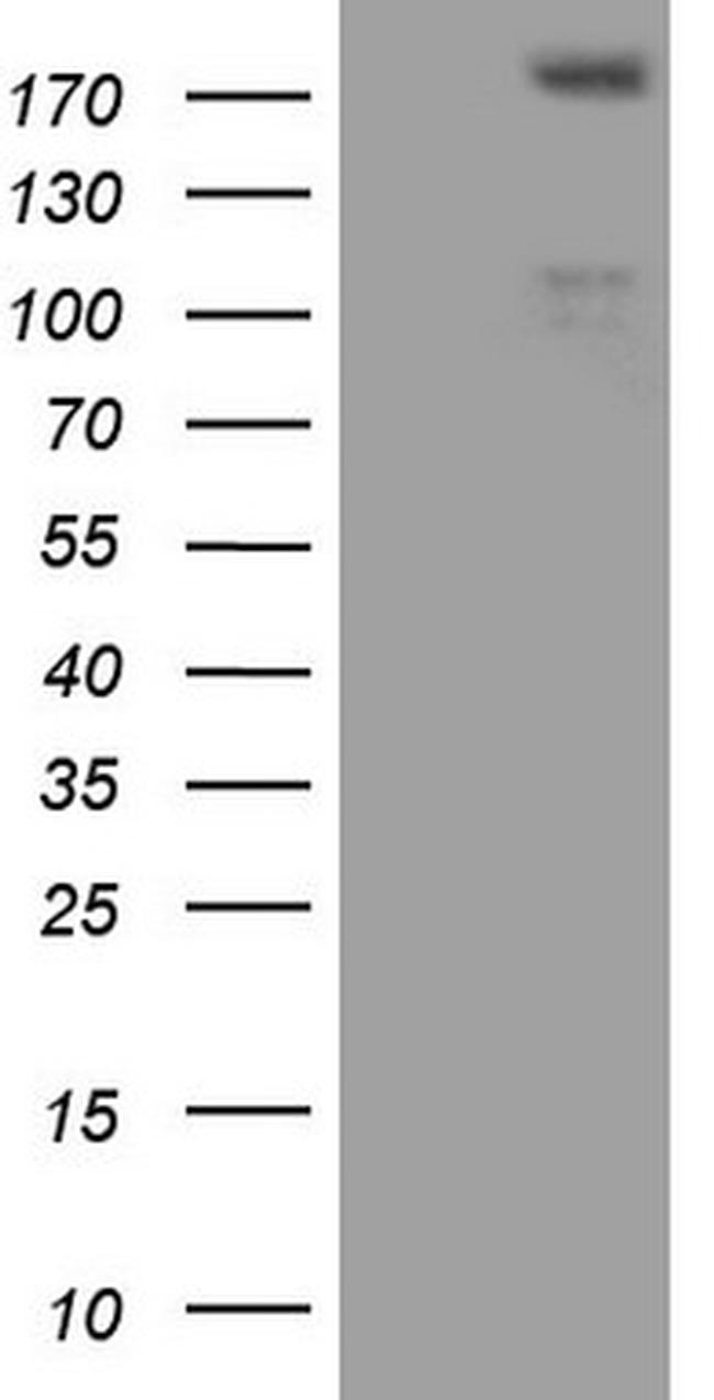 FLT4 Antibody in Western Blot (WB)