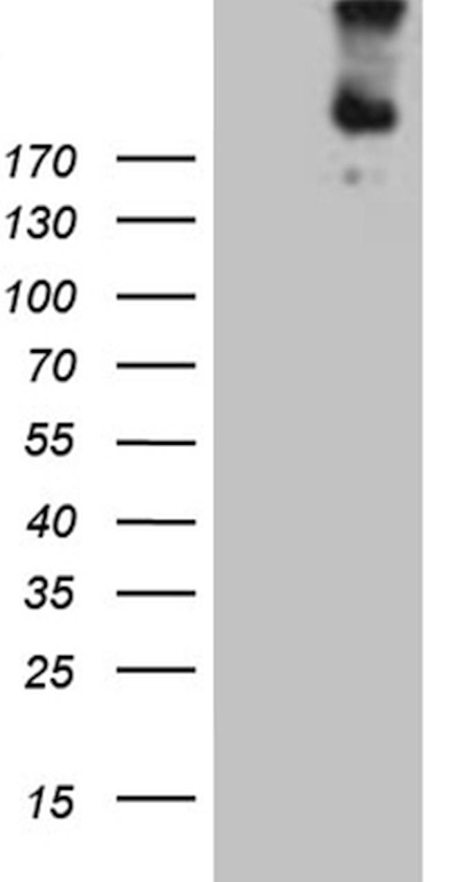 FLT4 Antibody in Western Blot (WB)