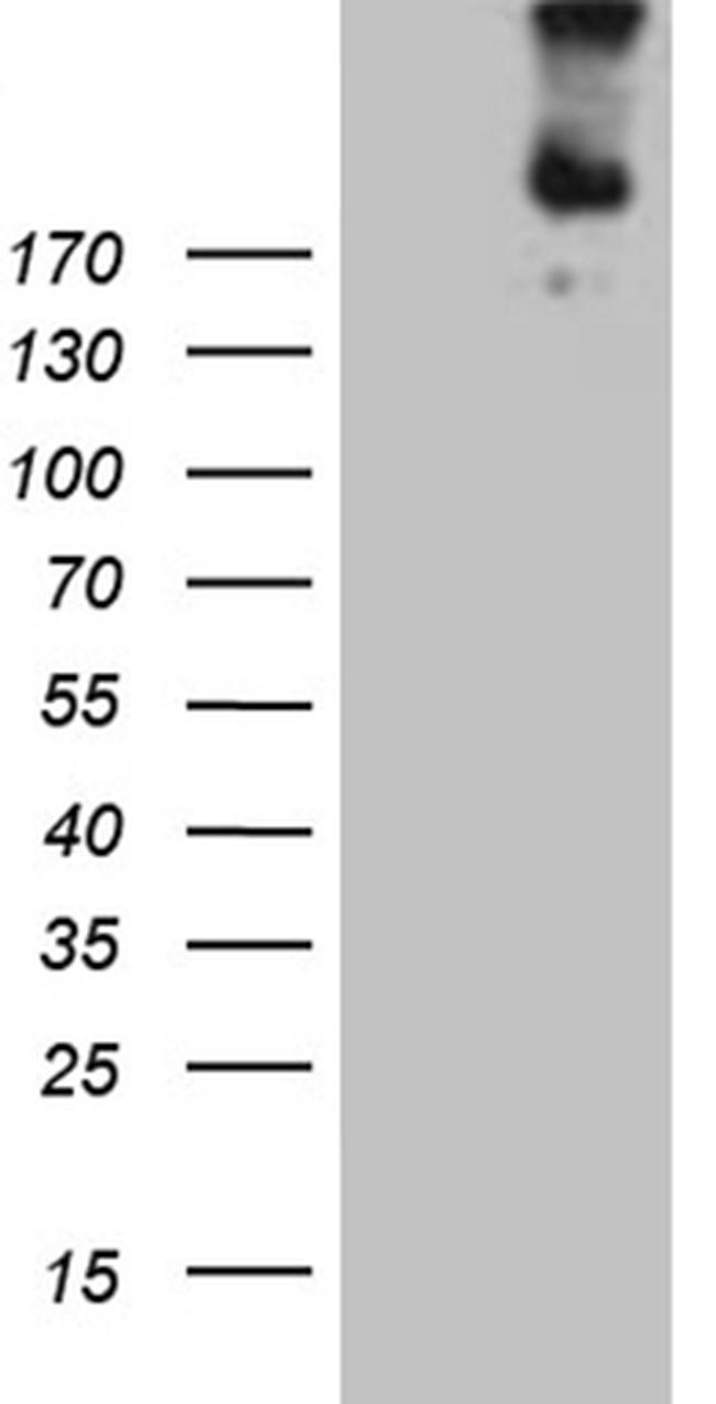 FLT4 Antibody in Western Blot (WB)