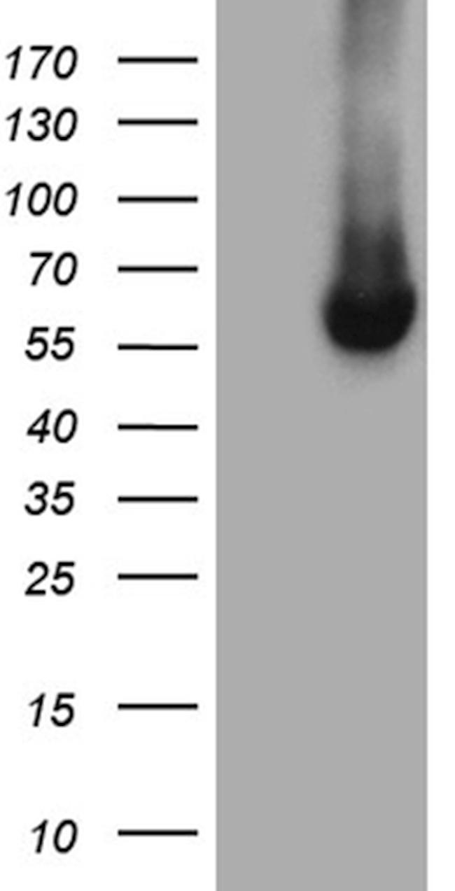 FMO3 Antibody in Western Blot (WB)