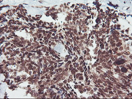 FMR1 Antibody in Immunohistochemistry (Paraffin) (IHC (P))