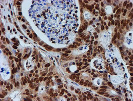 FMR1 Antibody in Immunohistochemistry (Paraffin) (IHC (P))