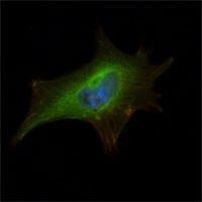 FMRP Antibody in Immunocytochemistry (ICC/IF)