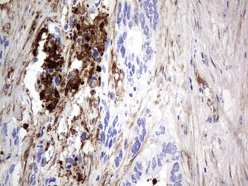 FN1 Antibody in Immunohistochemistry (Paraffin) (IHC (P))